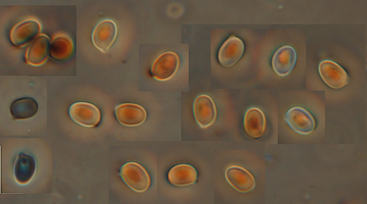 A. xantoderma?